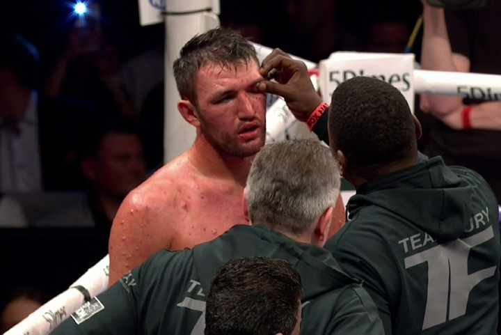 Image: Hughie Fury in negotiations with Joseph Parker