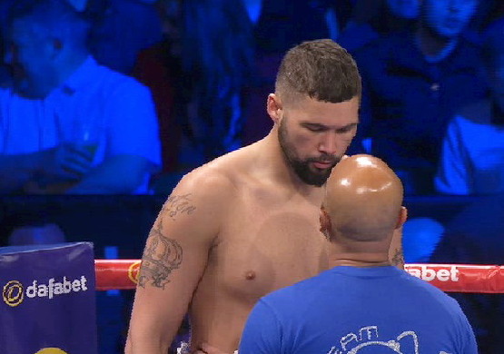 bellew7