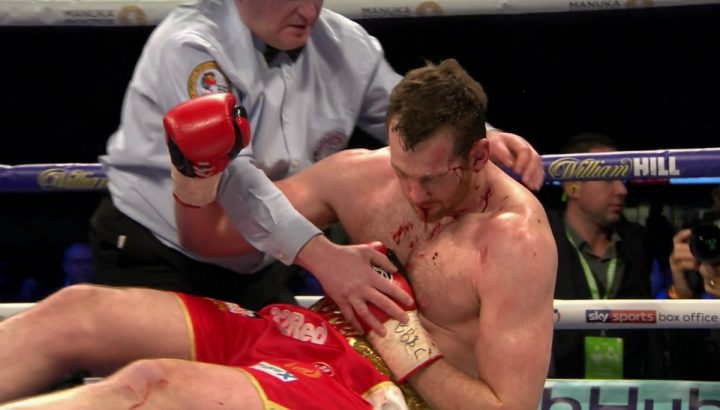 Image: David Price suffered fractured nose and needed 42 stiches to face in Povetkin fight