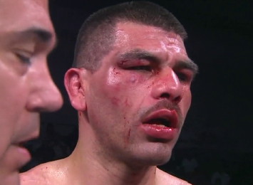Image: Angulo: Where does he go after the Kirkland beating?