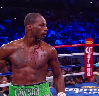 Image: Dawson wants to face Andre Ward next, could move down to 168