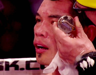 Image: Donaire could fight Arce in October, Nishioka in December