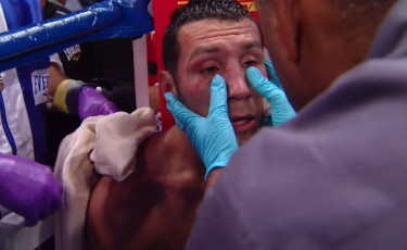 Image: Escobedo gets emotional after loss to Broner, says he didn't get a fair fight