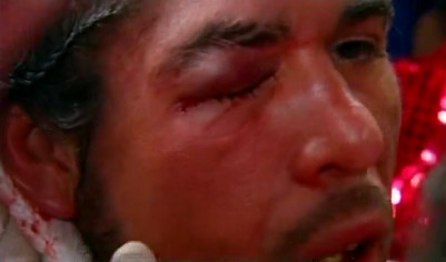Image: Margarito: I felt this was a repeat of my last fight against Cotto; I wanted one more round