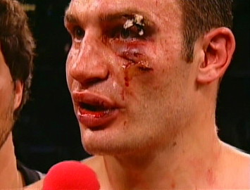 Image: Klitschko vs. Briggs: Shannon must focus on Vitali’s weak skin around his eyes