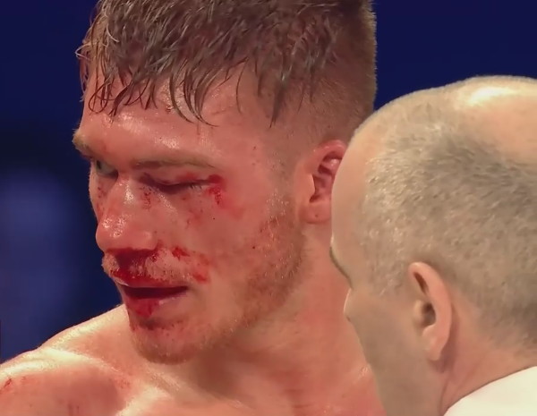 Image: Nick Blackwell's dramatic story and what lies behind it.