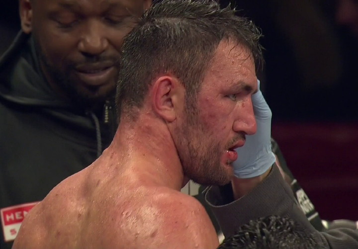 Image: Hughie Fury suffers injury, pulls out of Joseph Parker fight