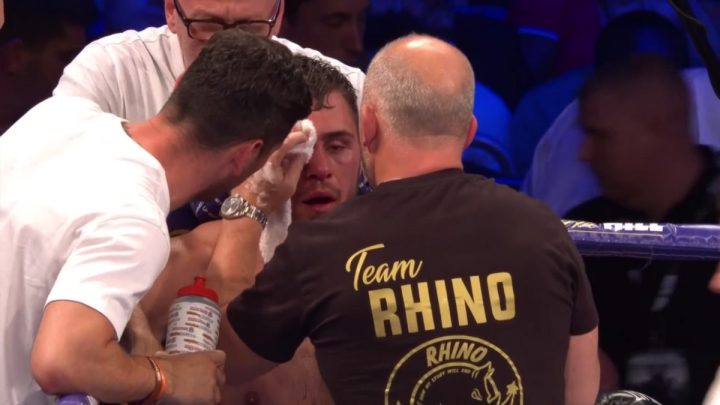 Image: Dave Allen hints at retirement following loss to David Price