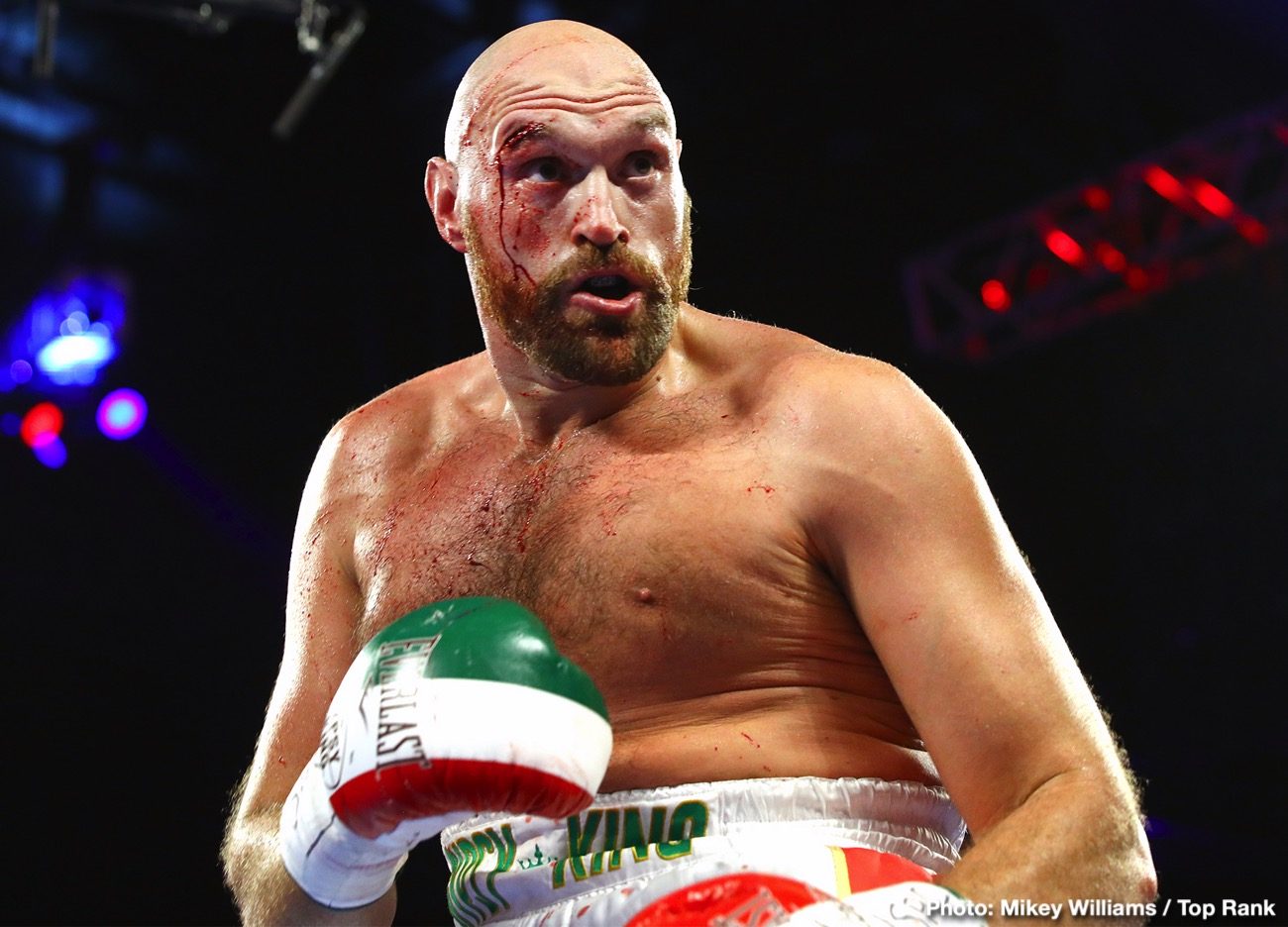 Image: Tyson Fury to Deontay Wilder: 'Don’t get injured against OLD man Luis Ortiz'