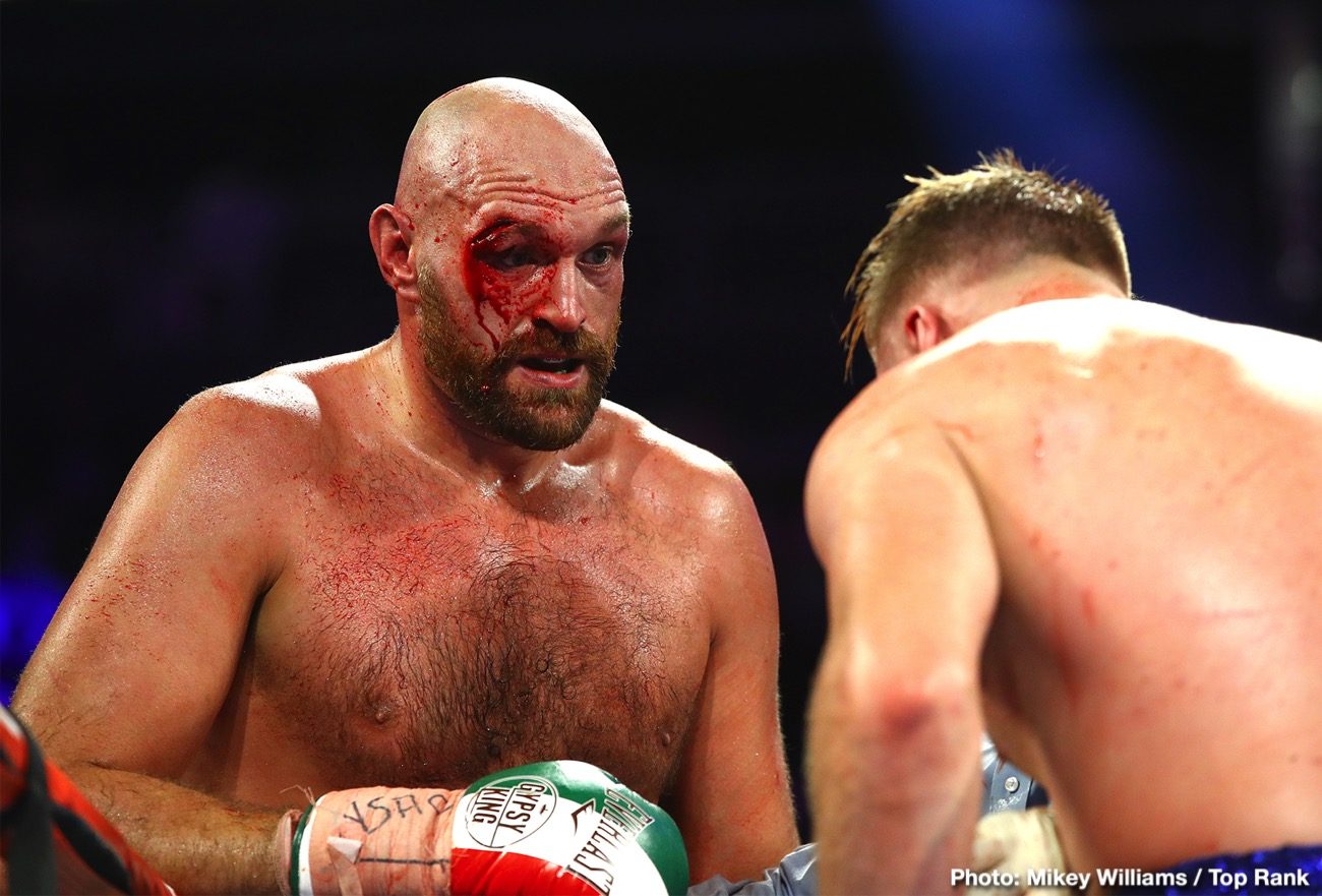 Image: Andy Ruiz: After 'Tyson Fury's performance, "NO way he beats me"