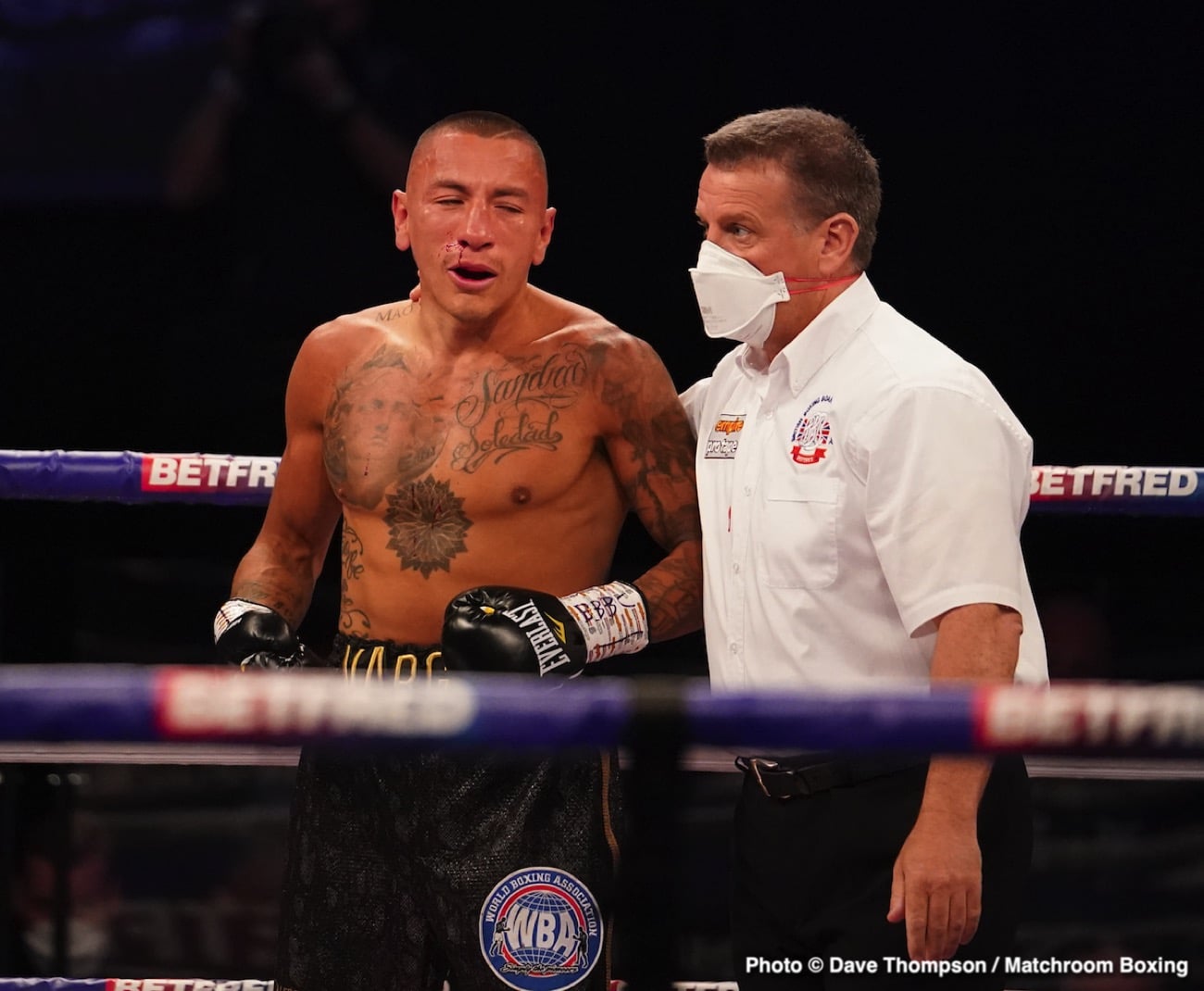Image: Boxing Results: Conor Benn stops Samuel Vargas in 1st round TKO
