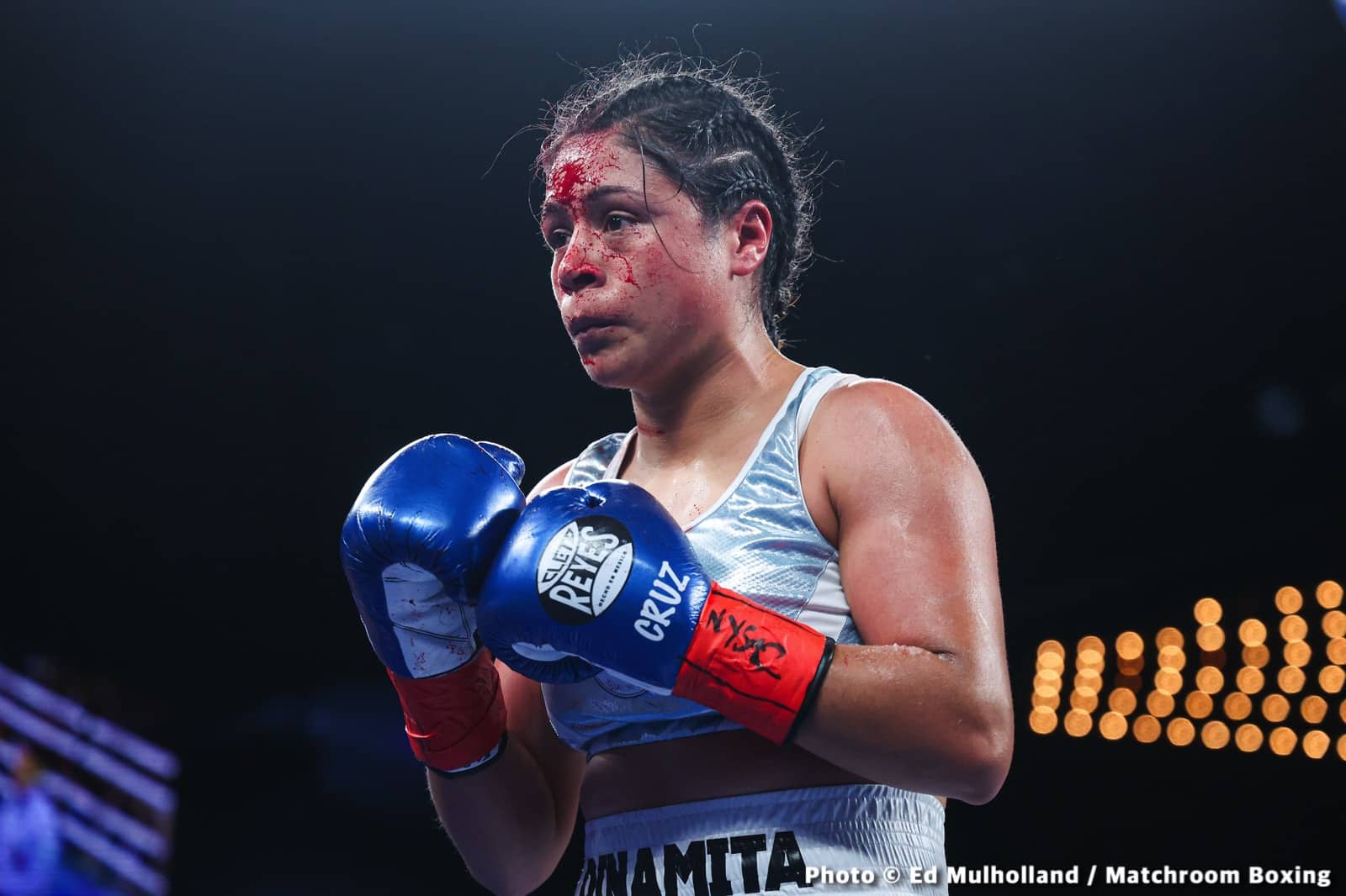 Image: Boxing Results: Amanda Serrano Wins War Over Erika Cruz!